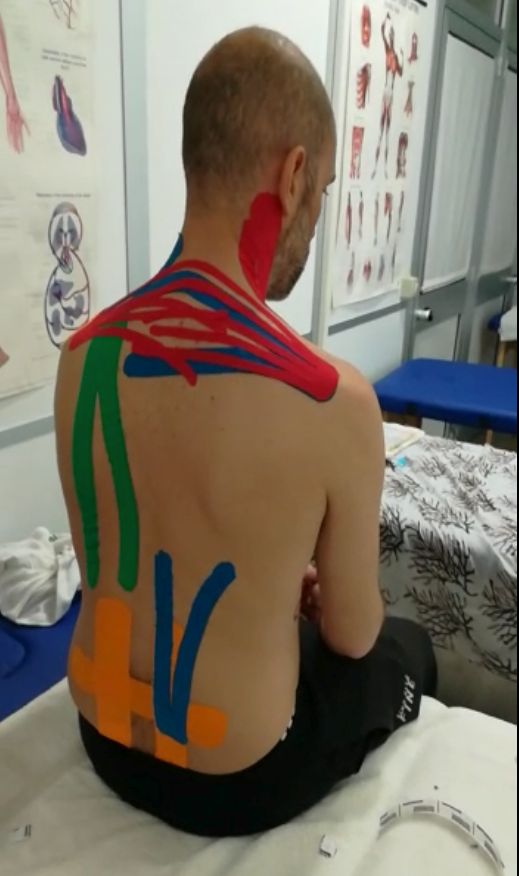 Kinesio Taping